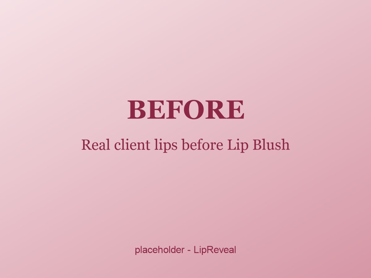 Real client before her brow treatment